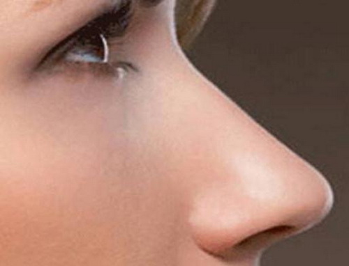 综合鼻整形术原理