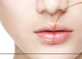 唇裂是什么原因造成的怎么检查