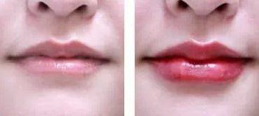 女人阴唇边长个红水泡是怎么了