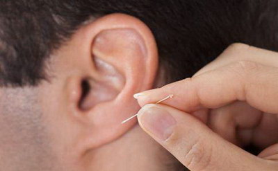 耳朵裂开了怎么办_耳朵可以做整形手术吗