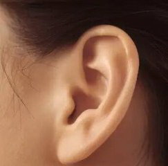 外耳廓整形需要多长时间_成都米兰柏羽整形医院耳廓整形
