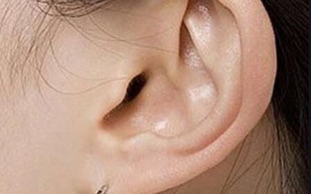 耳垂有皱纹能恢复吗