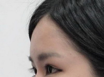 颌角整形的美容整形作用_北京下颌角整形去哪个医院