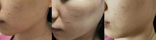 安徽省最好的皮肤科医院是哪家_女性改善皮肤的保健品