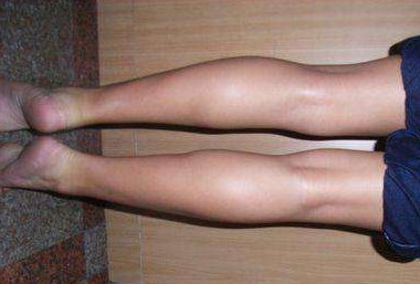 最简单的瘦腿方法有哪些