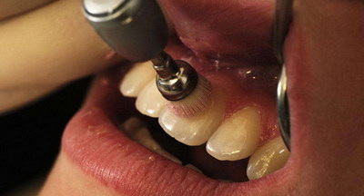 如何治疗牙龈为萎缩