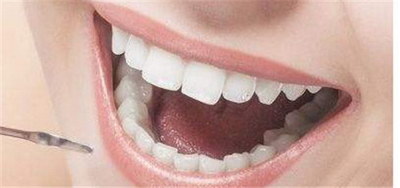 为什么牙结石会引起牙龈出血