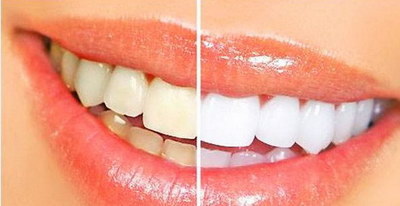 拔牙后多长时间镶牙_拔牙拆线之后需要注意什么