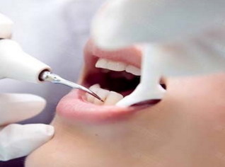 牙齿矫正手术需要做多久