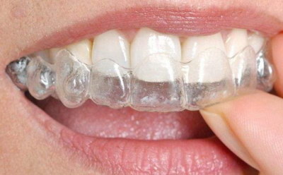 补完牙后牙齿剧烈疼痛是什么原因