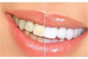 牙的根管治疗方法(牙根管治疗的方法)