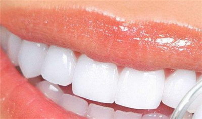 牙齿矫正时间过程(牙齿矫正时间推荐)