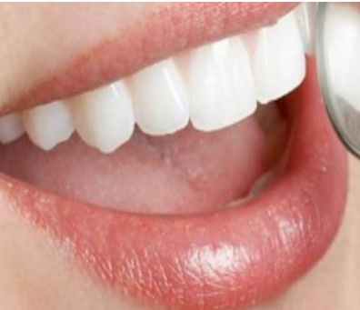 美白牙齿需要补充什么维生素
