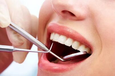 拔牙有牙洞该吃什么_拔牙后多久可以洁牙齿