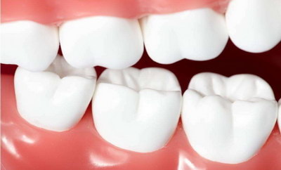 牙齿美白哪种效果最好「牙齿美白方式哪种效果好」