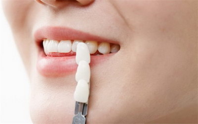 牙齿缺失怎么治疗