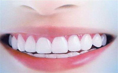 儿童乳牙越来越稀疏