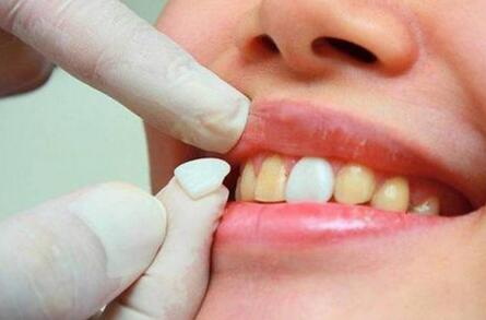 戴隐形牙套牙齿痛正常吗