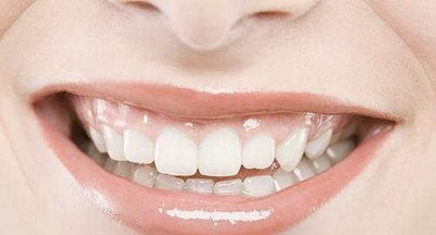 年龄大了牙齿松动了能恢复吗_带塑料牙套使牙齿恢复好吗