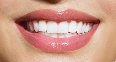 全锆牙就是二氧化锆全瓷牙吗