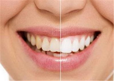 种植牙一般多长周期「种植牙的寿命一般有多长」