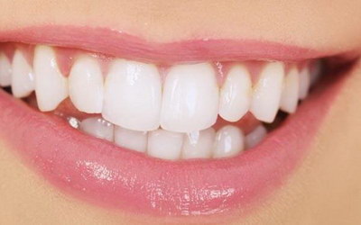 牙龈萎缩是什么回事(牙龈萎缩是怎么回事缺乏什么营养呢)