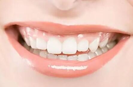怎样保护牙龈防止牙龈萎缩