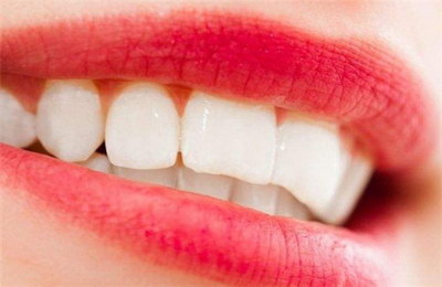 隐适美牙套是什么材质