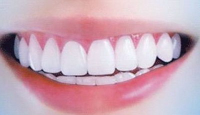 25岁还能做牙齿矫正要多长时间_儿童牙齿矫正器品牌