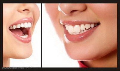 牙齿缝大是什么原因(牙齿缝大是什么原因造成的)