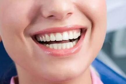 使牙齿变白的小妙招_牙齿矫正怎么分骨性还是牙性