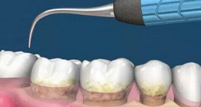 长期牙龈出血是肝的毛病吗