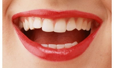 蓝光美白牙齿能保持多久(蓝光美白牙齿的副作用)
