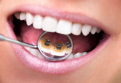 牙龈固定位置出血是什么原因