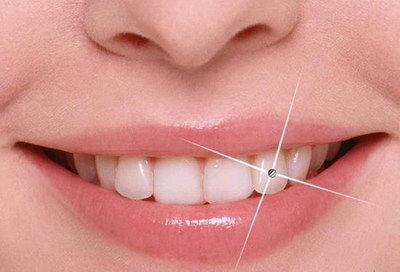 什么方法牙齿可以变白