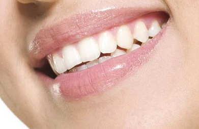 树脂美白牙齿贴面拆除可以恢复到原牙吗(树脂贴面美白牙齿)