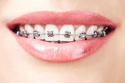 牙周炎导致牙齿脱落怎么治疗