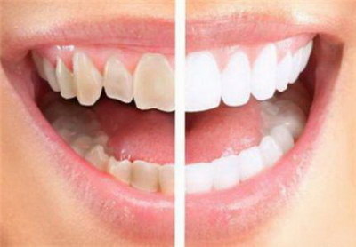 根管治疗后的牙能用多久(根管治疗的原理)