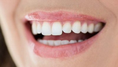 固定牙齿牙套可以戴多久