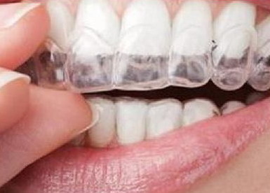 牙齿补好了为什么牙龈出血_经常牙龈出血的后果