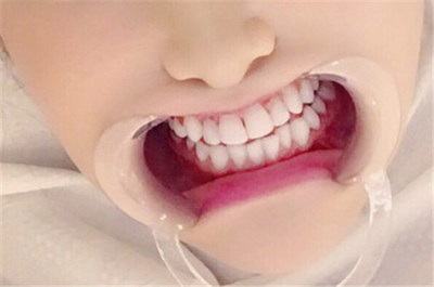 怎么补牙齿比较好(补牙的重要性)