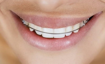 牙齿矫正适合什么年龄段