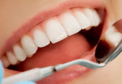 怎么治牙黄最快最简单方法