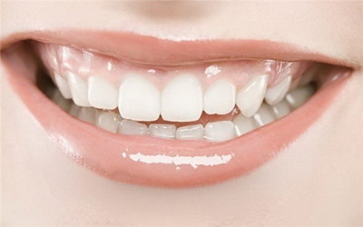 隐适美牙套是什么材料有多厚(隐适美牙套是什么材质的钢材)