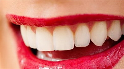 种植牙可以做牙齿矫正吗(种植牙以后还可以做牙齿矫正吗)