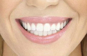 牙根管治疗填充是什么过程(牙根管治疗填充物是什么)