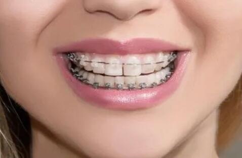 植牙后遗症风险_植牙和镶牙有什么区别