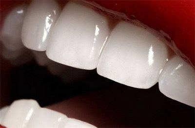成年人矫正牙齿一般多少钱