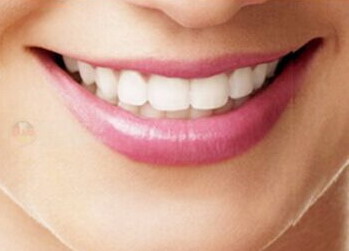 牙齿整形：改善你的容貌与健康