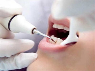 前牙根管治疗后是否需要打桩